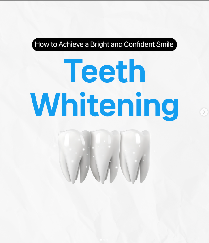 Illustration explaining how teeth whitening removes stains