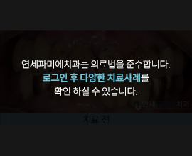 연세파미에치과는-의료법을-준수합니다. 로그인-후-다양한-치료사례를-확인-하실-수-있습니다.