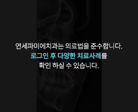 연세파미에치과는-의료법을-준수합니다. 로그인-후-다양한-치료사례를-확인-하실-수-있습니다.