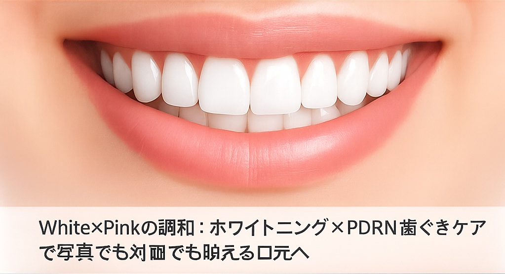 White×Pinkの調和：ホワイトニング×PDRN歯ぐきケアで写真でも対面でも映える口元へ