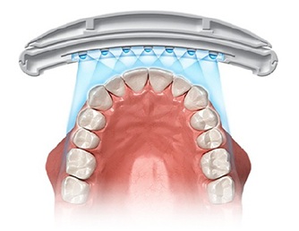 Features of the whitening light