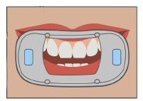 Step1